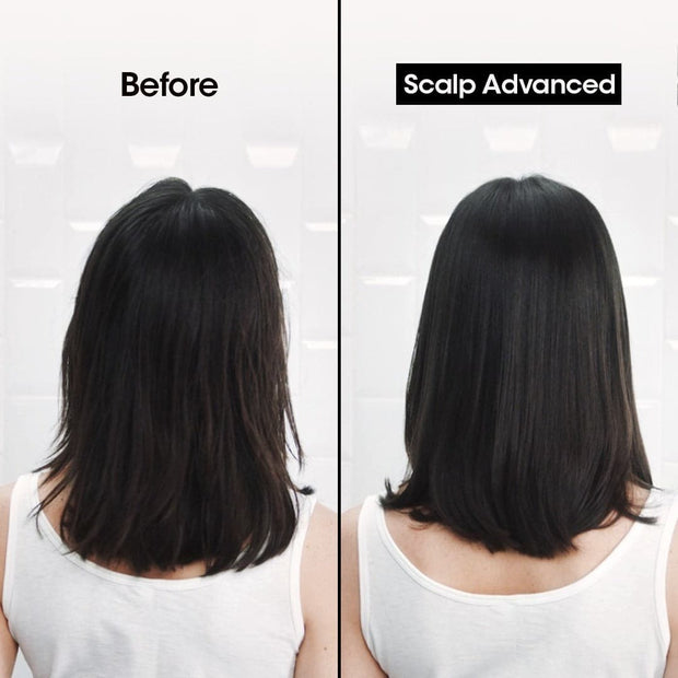 Loreal Professionnel Serie Expert Scalp Advanced Anti-Dandruff Shampoo 300ml