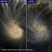 Jenpharm Anagrow Hair Serum